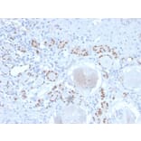 Immunohistochemistry - Anti-PAX8 Antibody [PAX8/2774R] (A250364) - Antibodies.com