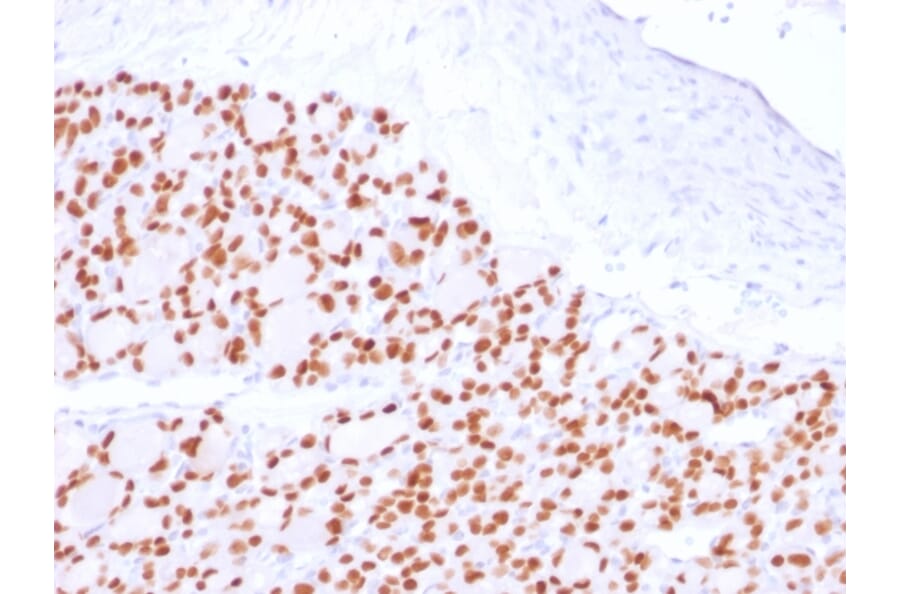 Immunohistochemistry - Anti-PAX8 Antibody [PAX8/2774R] (A250365) - Antibodies.com
