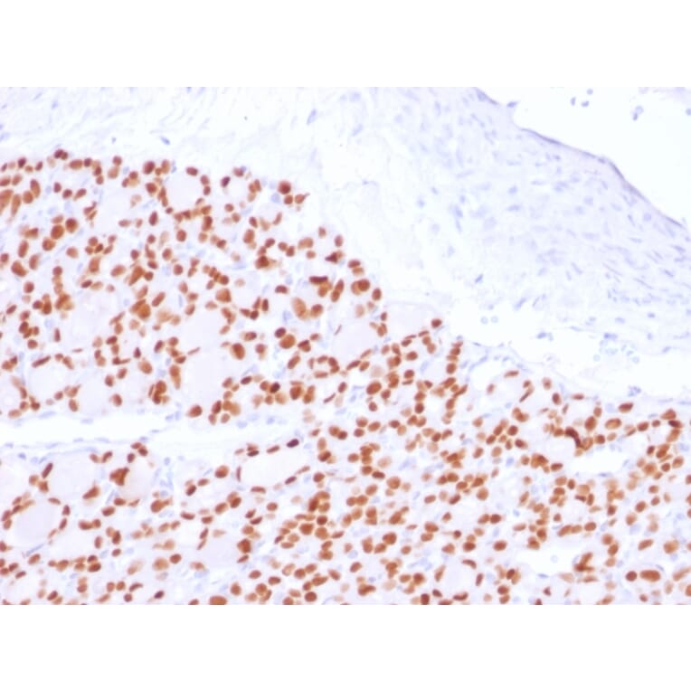 Immunohistochemistry - Anti-PAX8 Antibody [PAX8/2774R] (A250365) - Antibodies.com