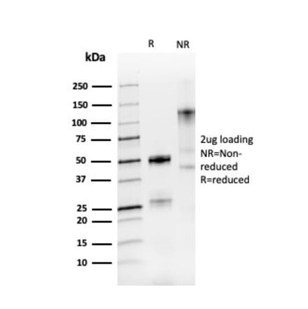 SDS-PAGE - Anti-PAX8 Antibody [PAX8/3688R] (A250366) - Antibodies.com