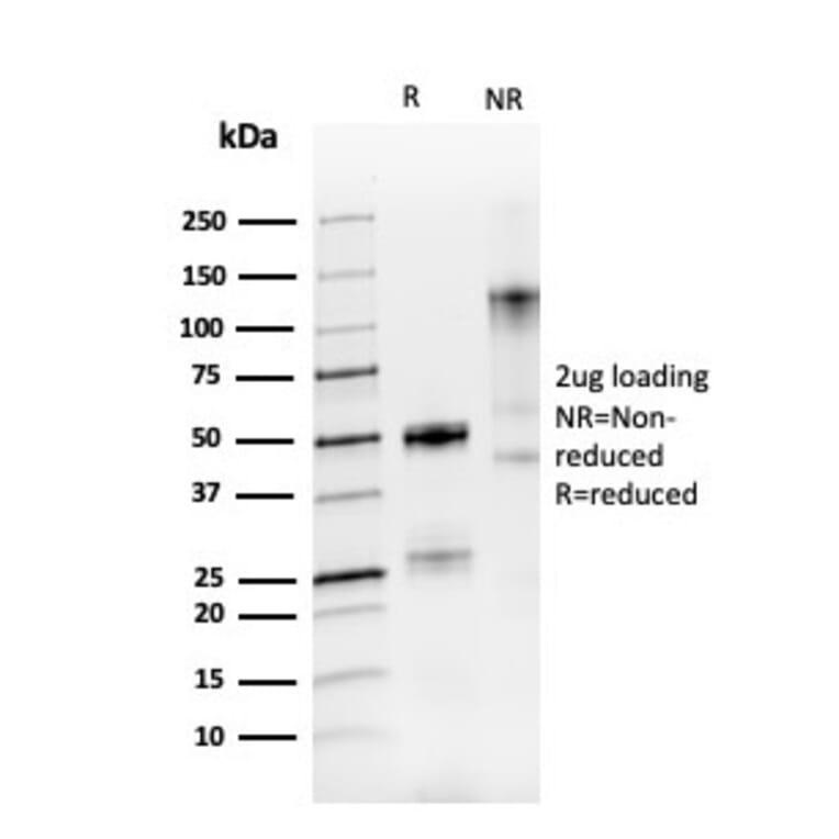 SDS-PAGE - Anti-PAX8 Antibody [PAX8/3688R] (A250366) - Antibodies.com