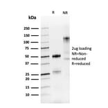 SDS-PAGE - Anti-PAX8 Antibody [PAX8/3688R] (A250366) - Antibodies.com