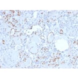 Immunohistochemistry - Anti-PAX8 Antibody [PAX8/3688R] (A250365) - Antibodies.com