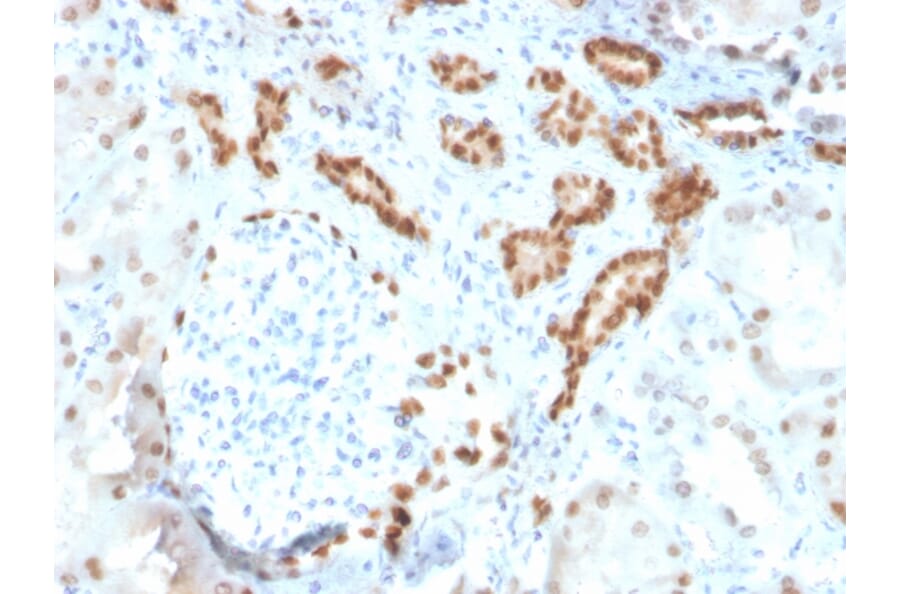 Immunohistochemistry - Anti-PAX8 Antibody [ZR-1] (A250366) - Antibodies.com
