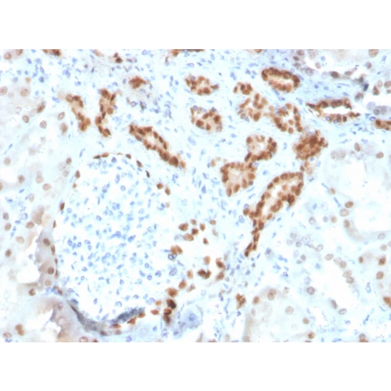 Immunohistochemistry - Anti-PAX8 Antibody [ZR-1] (A250366) - Antibodies.com