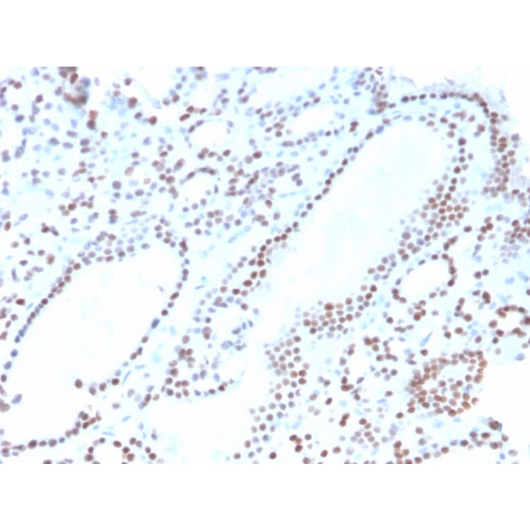 Immunohistochemistry - Anti-PAX8 Antibody [ZR-1] (A250367) - Antibodies.com