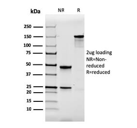SDS-PAGE - Anti-Calbindin Antibody [CALB1/2364] (A250369) - Antibodies.com