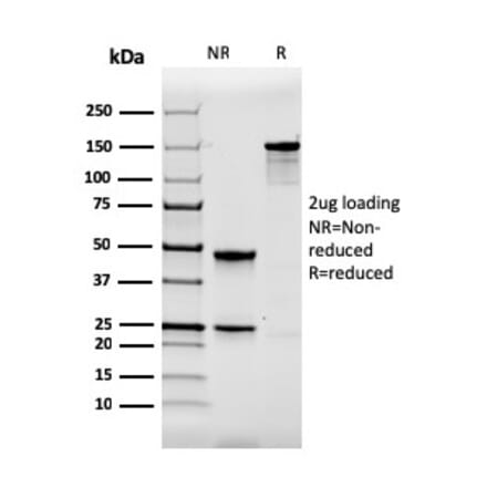 SDS-PAGE - Anti-Calbindin Antibody [CALB1/2364] (A250369) - Antibodies.com