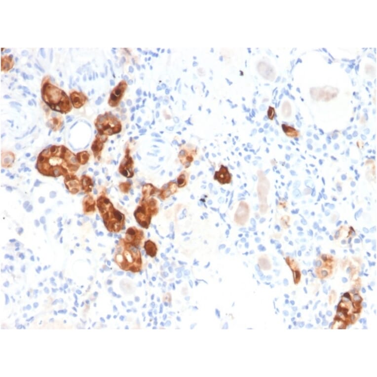 Immunohistochemistry - Anti-Calbindin Antibody [CALB1/2782] (A250370) - Antibodies.com