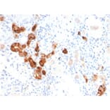 Immunohistochemistry - Anti-Calbindin Antibody [CALB1/2782] (A250370) - Antibodies.com