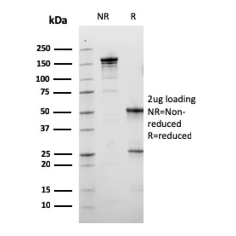 SDS-PAGE - Anti-Calbindin Antibody [CALB1/3333] (A250371) - Antibodies.com