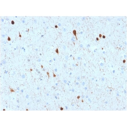 Immunohistochemistry - Anti-Calretinin Antibody [CALB2/2602] (A250372) - Antibodies.com