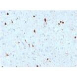 Immunohistochemistry - Anti-Calretinin Antibody [CALB2/2602] (A250372) - Antibodies.com