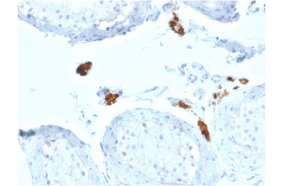 Immunohistochemistry - Anti-Calretinin Antibody [CALB2/2602] (A250372) - Antibodies.com