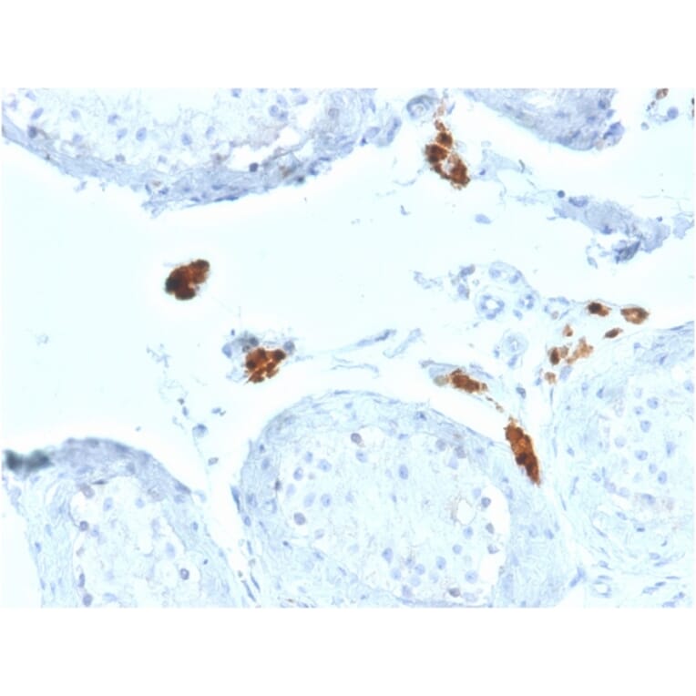 Immunohistochemistry - Anti-Calretinin Antibody [CALB2/2602] (A250372) - Antibodies.com