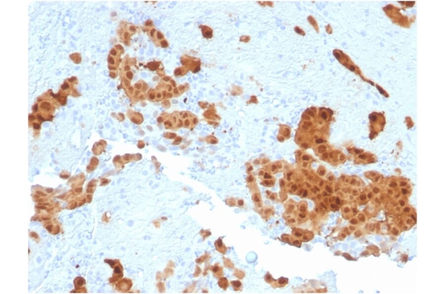 Immunohistochemistry - Anti-Calretinin Antibody [CALB2/2602] (A250372) - Antibodies.com