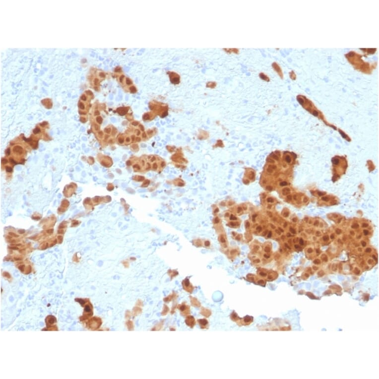 Immunohistochemistry - Anti-Calretinin Antibody [CALB2/2602] (A250372) - Antibodies.com