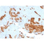 Immunohistochemistry - Anti-Calretinin Antibody [CALB2/2602] (A250372) - Antibodies.com