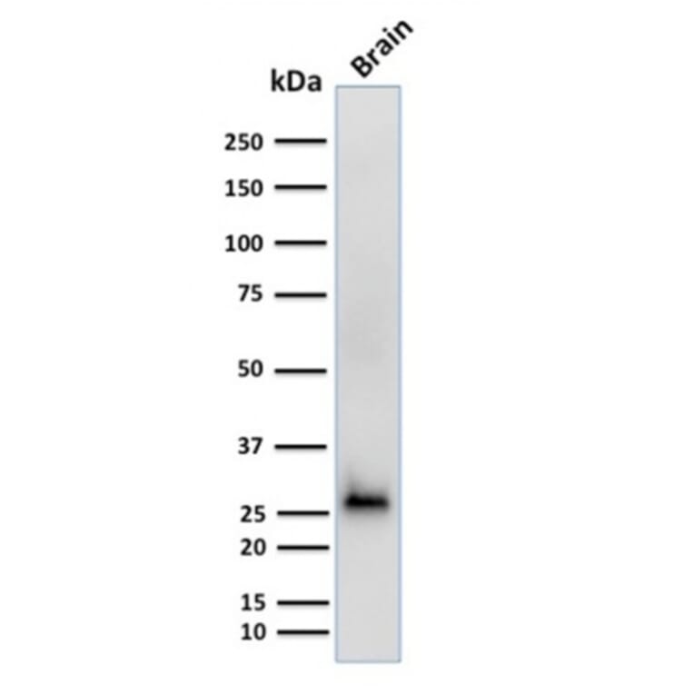 Western Blot - Anti-Calretinin Antibody [CALB2/2602] (A250372) - Antibodies.com