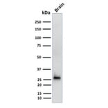 Western Blot - Anti-Calretinin Antibody [CALB2/2602] (A250372) - Antibodies.com