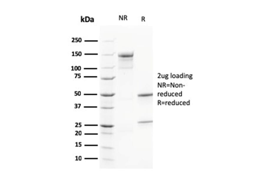 SDS-PAGE - Anti-Calretinin Antibody [CALB2/2602] (A250372) - Antibodies.com
