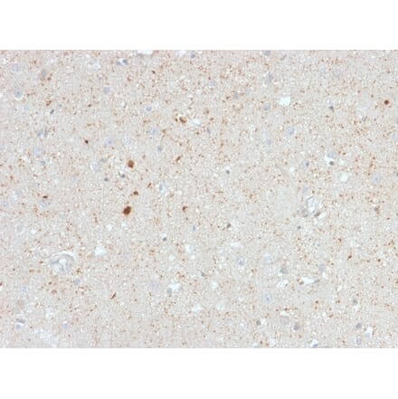 Immunohistochemistry - Anti-Calretinin Antibody [CALB2/2603] (A250373) - Antibodies.com