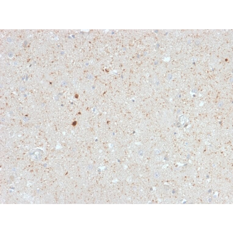 Immunohistochemistry - Anti-Calretinin Antibody [CALB2/2603] (A250373) - Antibodies.com