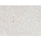 Immunohistochemistry - Anti-Calretinin Antibody [CALB2/2603] (A250373) - Antibodies.com