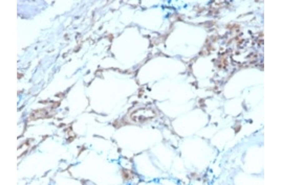 Immunohistochemistry - Anti-Calretinin Antibody [CALB2/2603] (A250373) - Antibodies.com