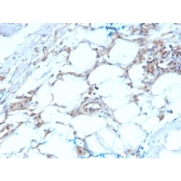 Immunohistochemistry - Anti-Calretinin Antibody [CALB2/2603] (A250373) - Antibodies.com