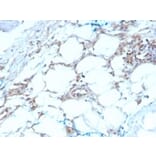 Immunohistochemistry - Anti-Calretinin Antibody [CALB2/2603] (A250373) - Antibodies.com