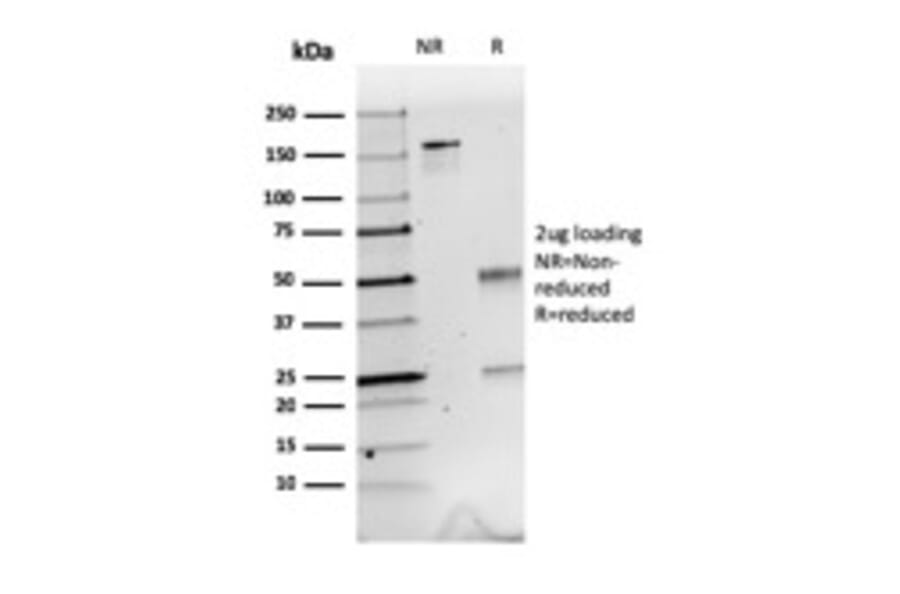 SDS-PAGE - Anti-Calretinin Antibody [CALB2/2603] (A250373) - Antibodies.com