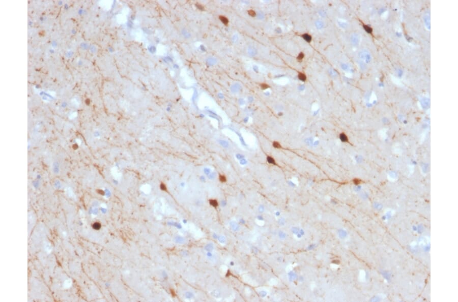 Immunohistochemistry - Anti-Calretinin Antibody [CALB2/2685] (A250374) - Antibodies.com
