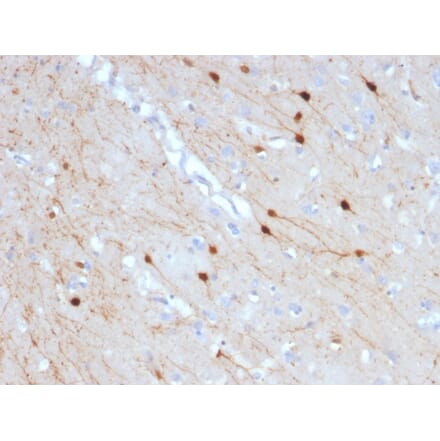 Immunohistochemistry - Anti-Calretinin Antibody [CALB2/2685] (A250374) - Antibodies.com