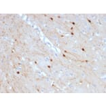 Immunohistochemistry - Anti-Calretinin Antibody [CALB2/2685] (A250374) - Antibodies.com