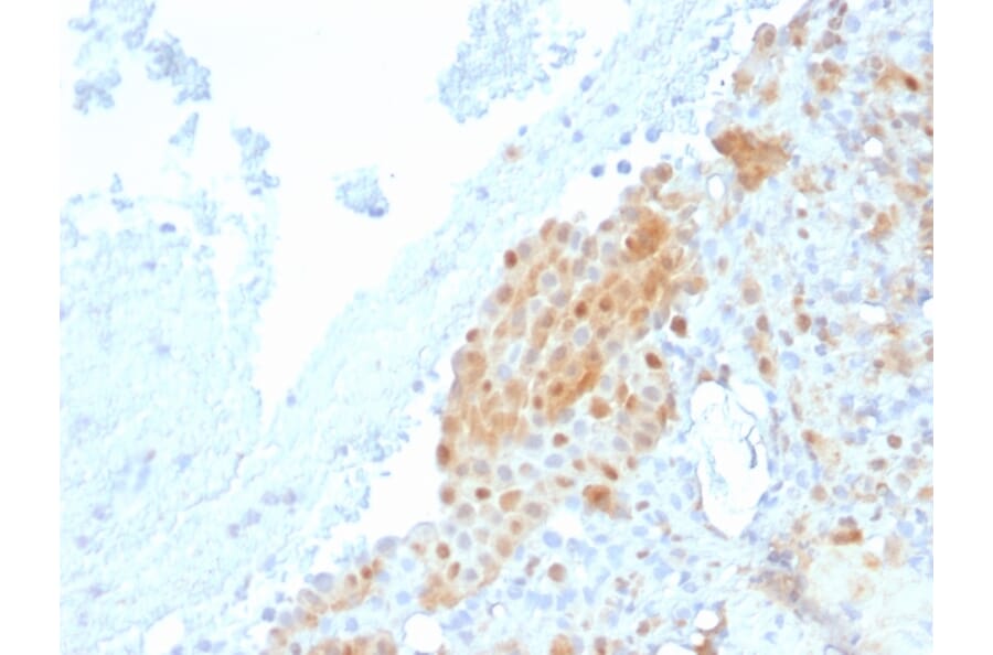 Immunohistochemistry - Anti-Calretinin Antibody [CALB2/2685] (A250374) - Antibodies.com