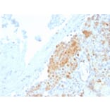 Immunohistochemistry - Anti-Calretinin Antibody [CALB2/2685] (A250374) - Antibodies.com