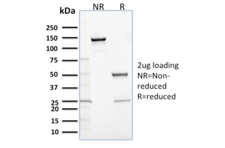 SDS-PAGE - Anti-Calretinin Antibody [CALB2/2685] (A250374) - Antibodies.com