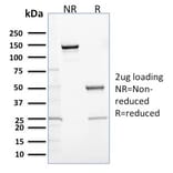 SDS-PAGE - Anti-Calretinin Antibody [CALB2/2685] (A250374) - Antibodies.com