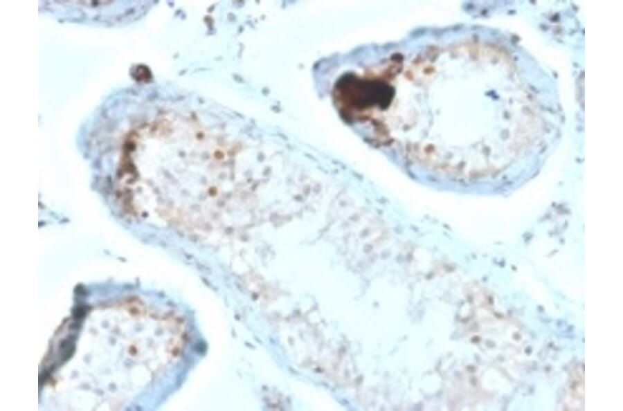 Immunohistochemistry - Anti-Calretinin Antibody [CALB2/2685] (A250374) - Antibodies.com