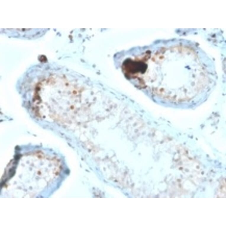 Immunohistochemistry - Anti-Calretinin Antibody [CALB2/2685] (A250374) - Antibodies.com