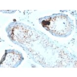 Immunohistochemistry - Anti-Calretinin Antibody [CALB2/2685] (A250374) - Antibodies.com