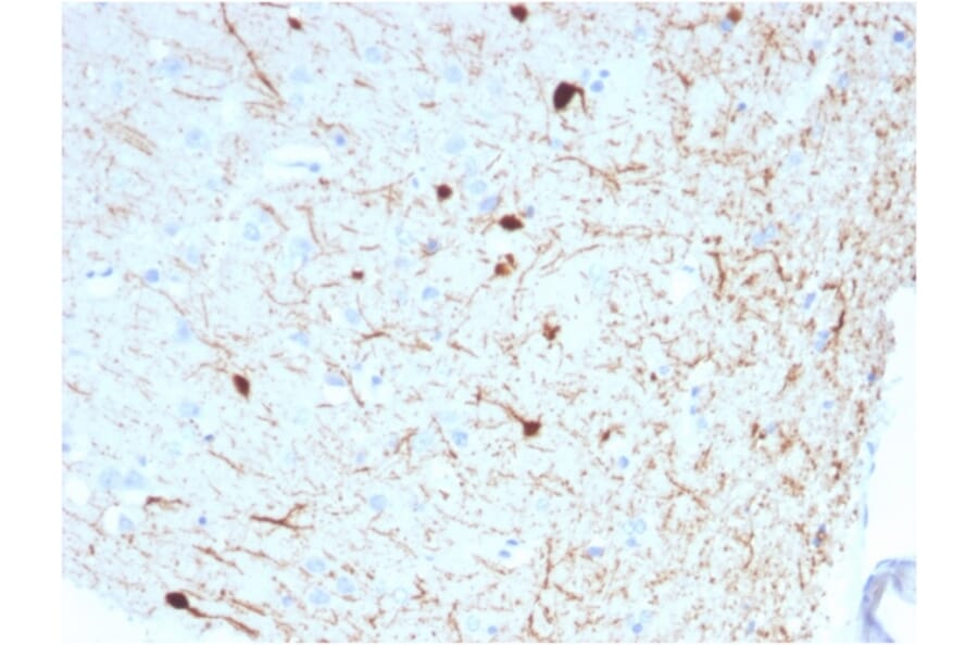 Immunohistochemistry - Anti-Calretinin Antibody [CALB2/2786] (A250375) - Antibodies.com