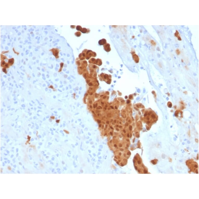 Immunohistochemistry - Anti-Calretinin Antibody [CALB2/2786] (A250375) - Antibodies.com