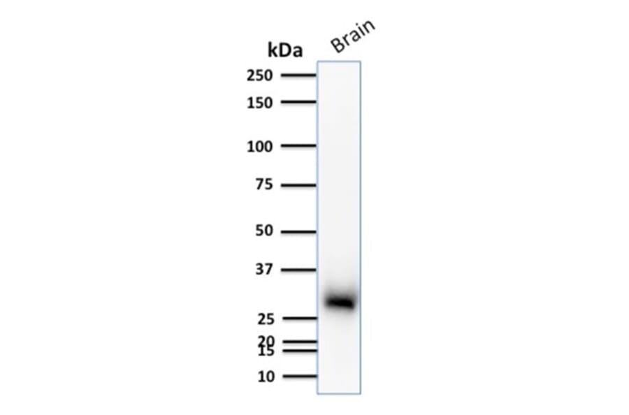 Western Blot - Anti-Calretinin Antibody [CALB2/2786] (A250375) - Antibodies.com
