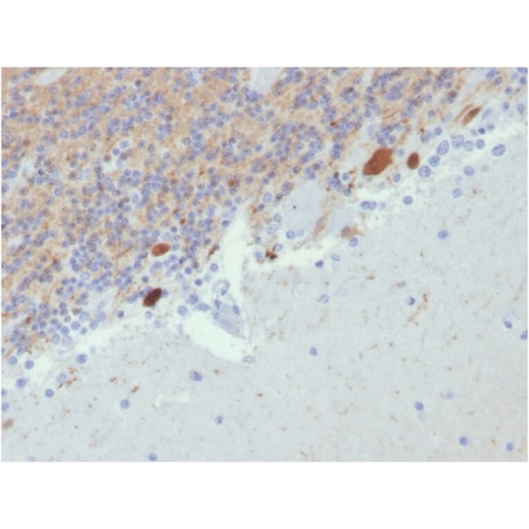 Immunohistochemistry - Anti-Calretinin Antibody [CALB2/2807] (A250376) - Antibodies.com
