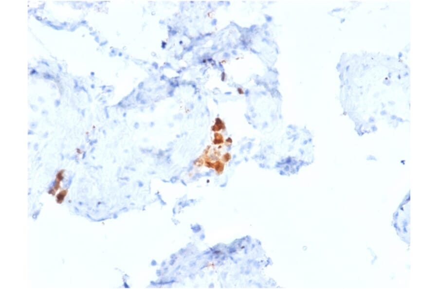 Immunohistochemistry - Anti-Calretinin Antibody [CALB2/2807] (A250376) - Antibodies.com