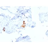 Immunohistochemistry - Anti-Calretinin Antibody [CALB2/2807] (A250376) - Antibodies.com