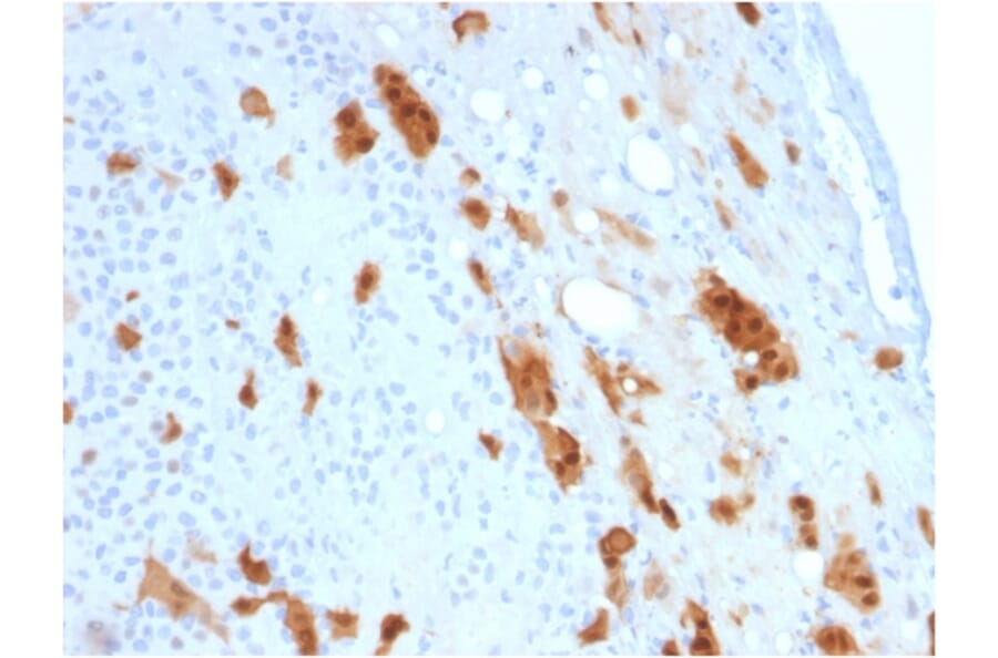 Immunohistochemistry - Anti-Calretinin Antibody [CALB2/2807] (A250376) - Antibodies.com