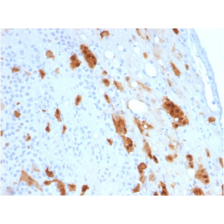 Immunohistochemistry - Anti-Calretinin Antibody [CALB2/2807] (A250376) - Antibodies.com